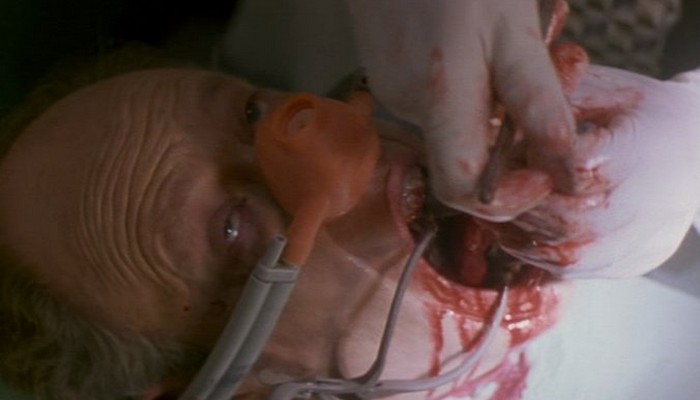 civictv-the-dentist-1996-10
